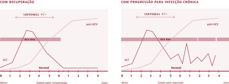 GermanodeSousa-Hepatite-C-Infeccao-aguda-HCV