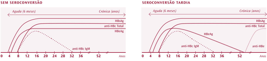 GermanodeSousa-Progressao-para-Hepatite-B-cronica