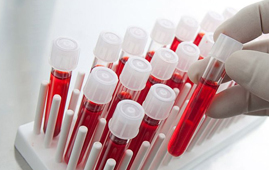 Incompatibilidade sanguínea na gravidez