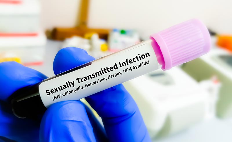 O Que são IST: Entenda as Infeções Sexualmente Transmissíveis