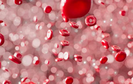 Dislipidémias: O que são? - Sapo LyfeStyle