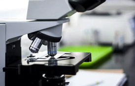 Tricuríase: O que é e como se faz o diagnóstico laboratorial?  - Sapo Lifestyle