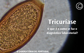 Tricuríase: O que é e como se faz o diagnóstico laboratorial?