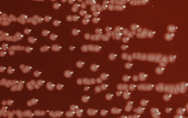 Sapo Lifestyle - Doenças do Estômago - Teste de Yersinia