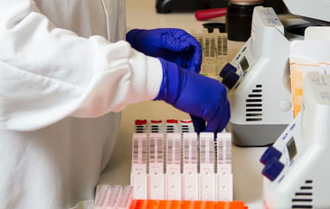 Distúrbios hematológicos: O teste de protrombina - Sapo Lifystyle