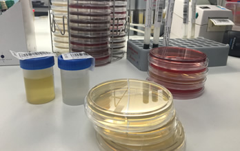 Rastreio da Bacteriúria Assintomática na Gravidez