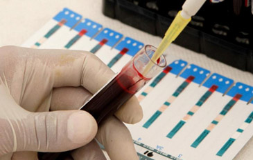 Podemos beber água antes de fazer análises ao sangue? - TVI notícias