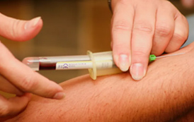 Hipercolesterolemia familiar: quando a acumulação de colesterol é um problema de família - Sapo Lifestyle