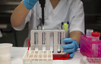 Fibrose Quística: Aconselhamento genético e diagnóstico laboratorial - Sapo Lifestyle