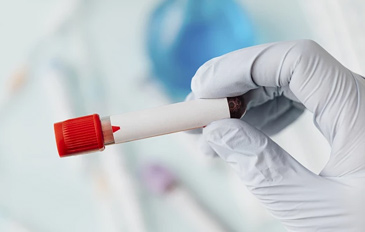 O que é o Tempo de Tromboplastina Parcial Ativada? - Sapo Lifystyle