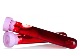 A determinação do grupo Rh na prevenção da doença hemolítica do recém-nascido