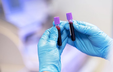 Síndrome de Sanfilippo: como é o diagnóstico? - SapoLifestyle