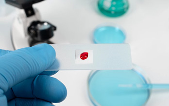 O que é a fusariose? Conheça os sintomas e o diagnóstico - SapoLifestyle