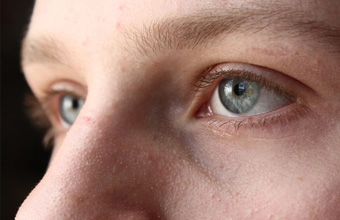 Esclerose Tuberosa: alterações genéticas e moleculares