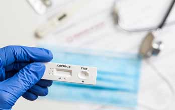 Covid 19: Governo prepara plano de testagem em massa. 400 mil testes de 14 em 14 dias   - Radiocampanario.com