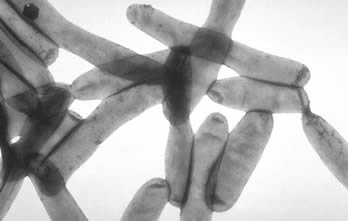 Legionella