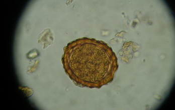 Ascaris lumbricoides