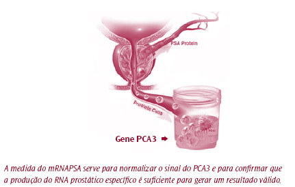germanodesousa_PCA_O_gene_3_do_cancro_da_prostata